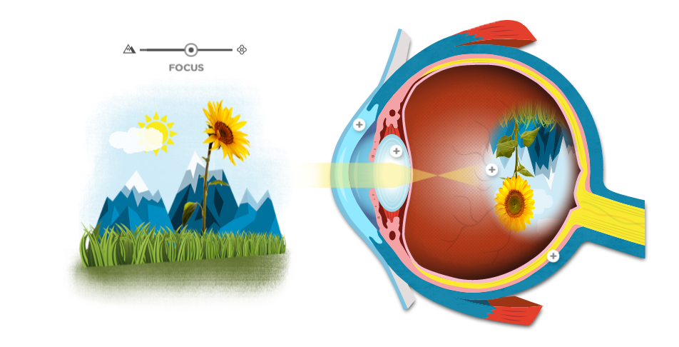 Lens adjusts focal length